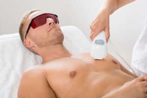 Dépilation Laser Dépilation Laser